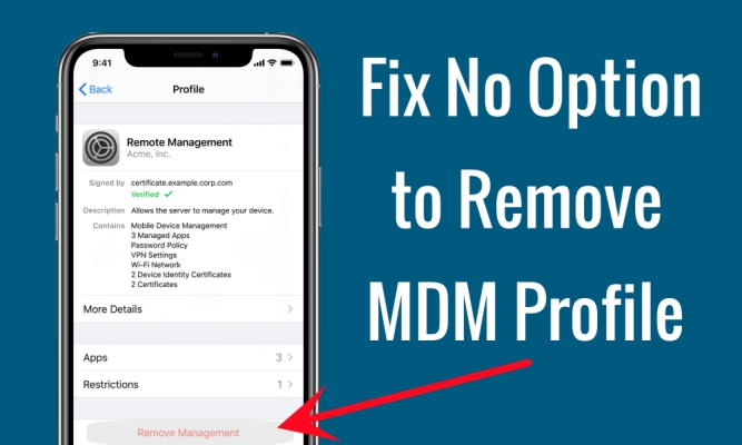 no option to remove mdm profile